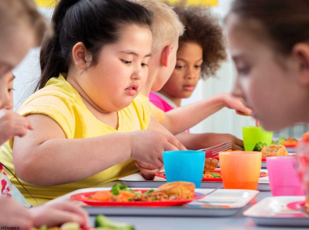 چاقی کودکان