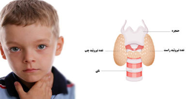 علائم کم کاری تیروئید در کودکان
