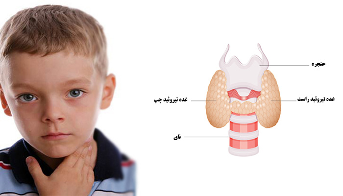 علائم کم‌ کاری تیروئید در کودکان
