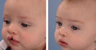 لبخندی که بر لبان ۶۸ کودک بیمار خراسان شمالی نشست