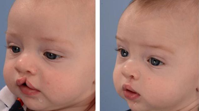 لبخندی که بر لبان ۶۸ کودک بیمار خراسان شمالی نشست