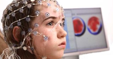 کودکان مبتلا به صرع