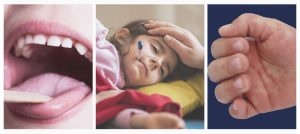 سندرمی نادر