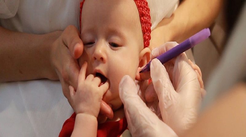 سوراخ کردن گوش