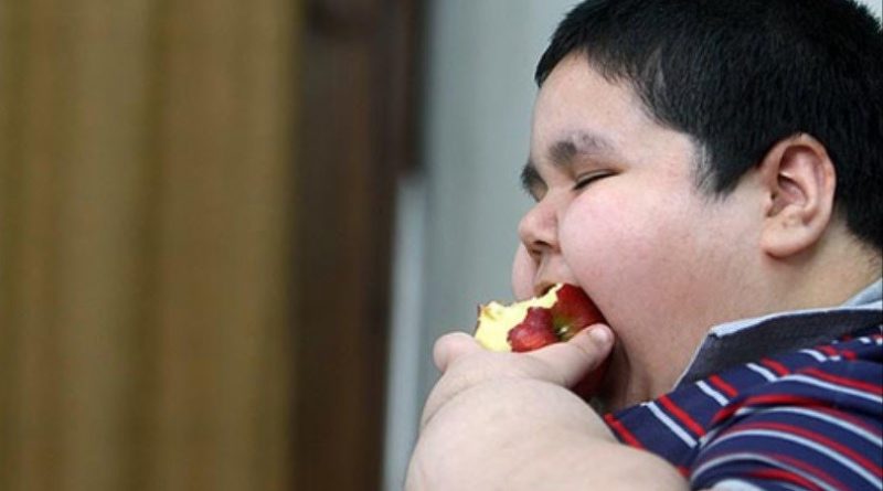 کودکان مبتلا به چاقی