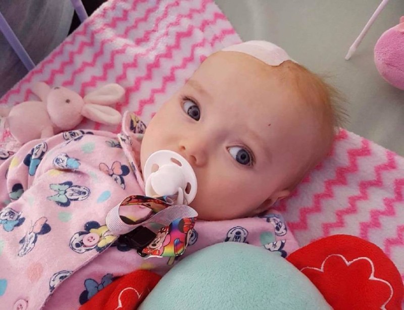 تومور مغزی در کودکان