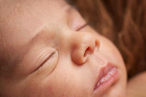 درمان ترک لب نوزادان
