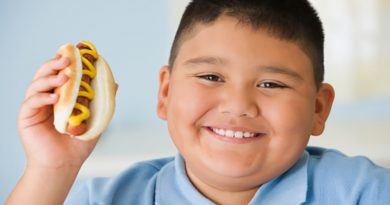 چاقی کودکان