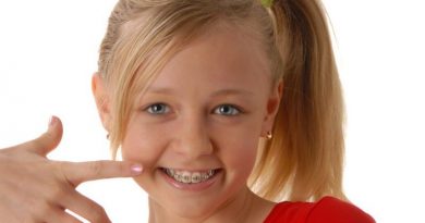 کج در آمدن دندان