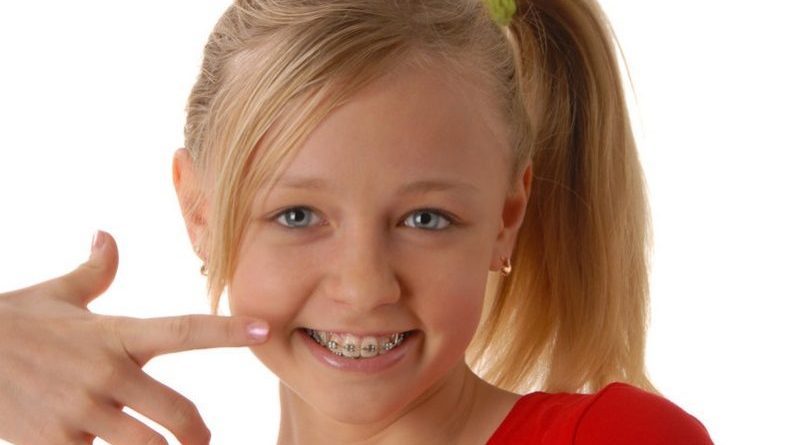 کج در آمدن دندان