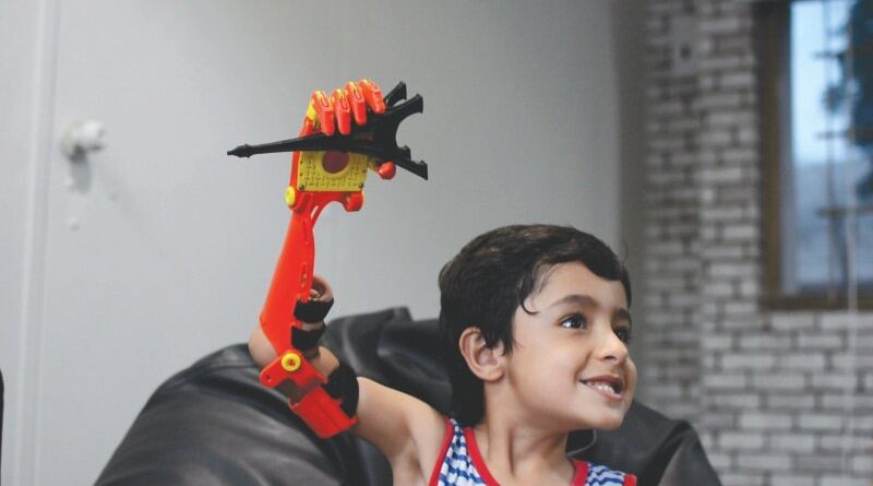 ابداع بازوی مصنوعی خورشیدی برای یک پسر ۸ ساله - سازمان پیشاهنگی استان فارس