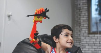 بازوی مصنوعی