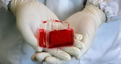 خون بند ناف نوزاد