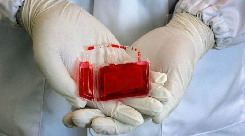 خون بند ناف نوزاد