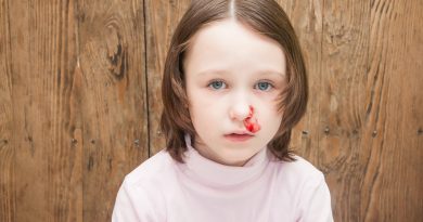 شکستگی بینی