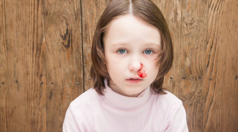 شکستگی بینی