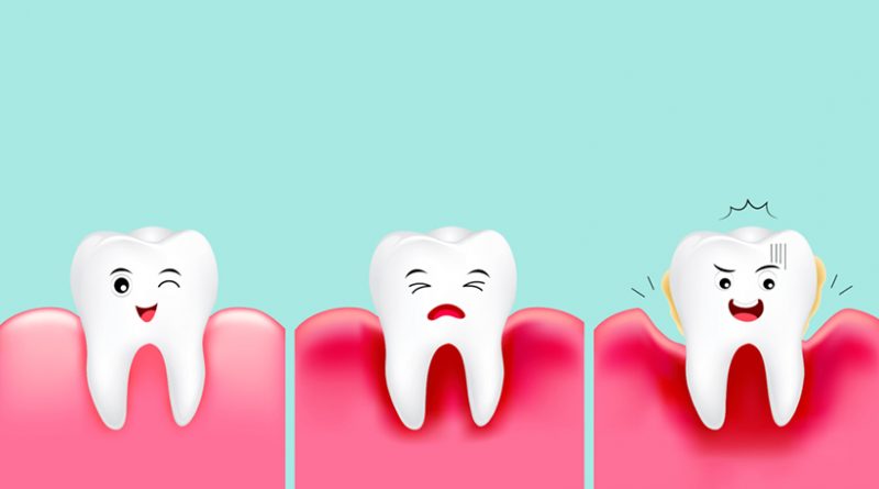 خونریزی لثه