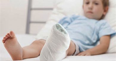 گچ گرفتن دست و پای کودک