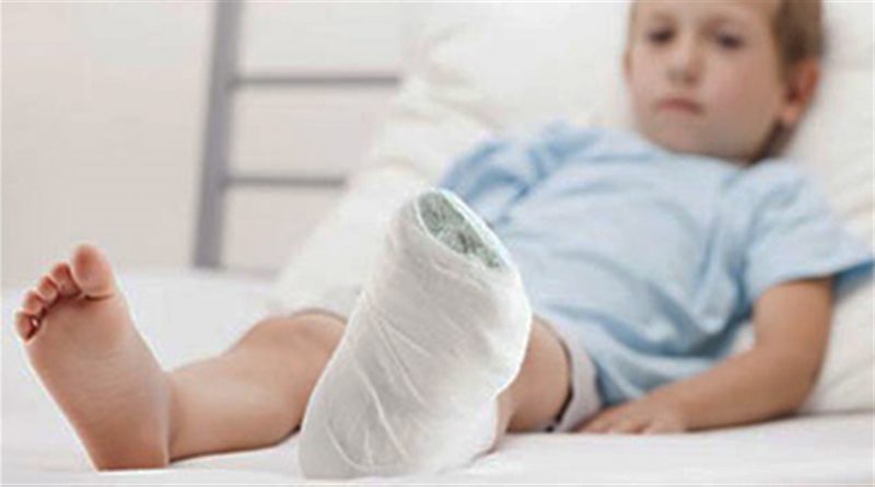 گچ گرفتن دست و پای کودک