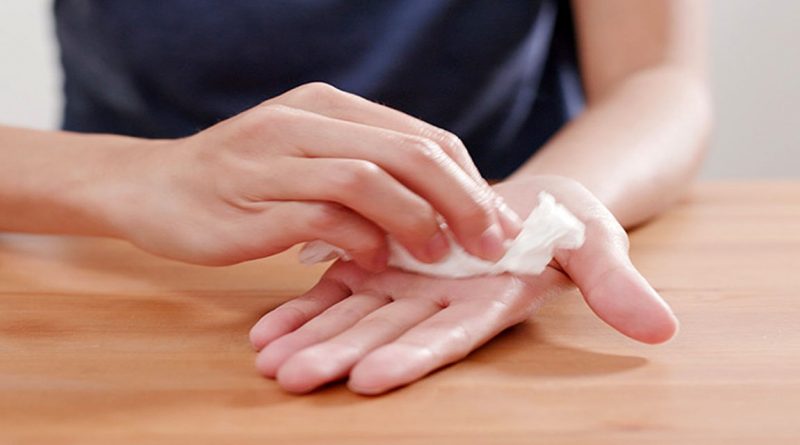 عرق کردن دست