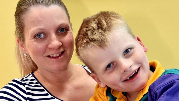 سندرم آنجلمن