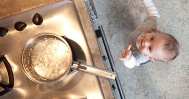 سوختگی در کودکان