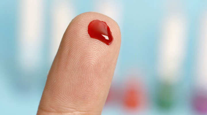 پلاکت‌های خون