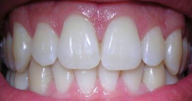 رشد مجدد دندان‌ها