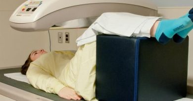 تراکم استخوان