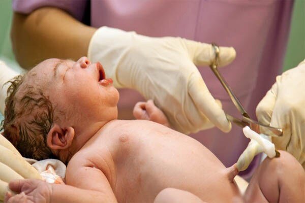 ذخیره‌سازی سلول‌های بنیادی