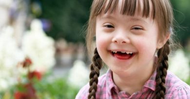 کودک سندروم داون