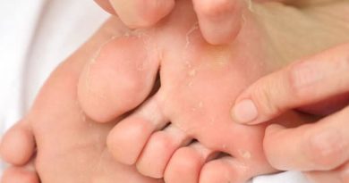 پوسته پوسته