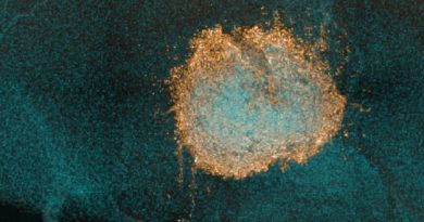 تومورهای مغزی