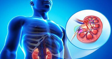 بیماری کلیوی