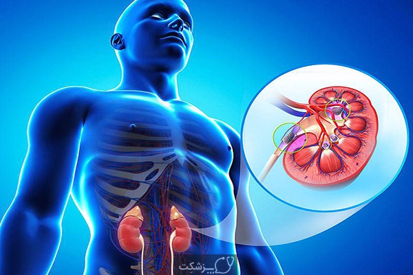بیماری کلیوی