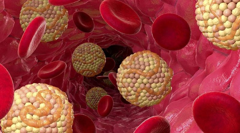 کلسترول بالا